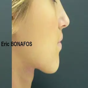 Bild von Dr Eric BONAFOS Chirurgien Esthétique Montpellier Chirurgie de la face et du cou