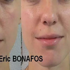 Bild von Dr Eric BONAFOS Chirurgien Esthétique Montpellier Chirurgie de la face et du cou