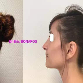 Bild von Dr Eric BONAFOS Chirurgien Esthétique Montpellier Chirurgie de la face et du cou