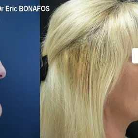 Bild von Dr Eric BONAFOS Chirurgien Esthétique Montpellier Chirurgie de la face et du cou