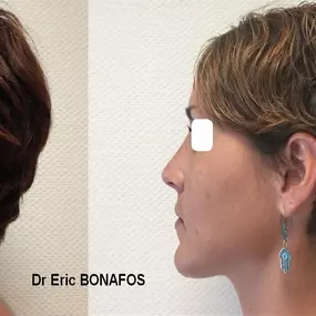 Bild von Dr Eric BONAFOS Chirurgien Esthétique Montpellier Chirurgie de la face et du cou