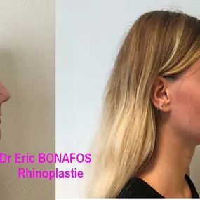 Bild von Dr Eric BONAFOS Chirurgien Esthétique Montpellier Chirurgie de la face et du cou