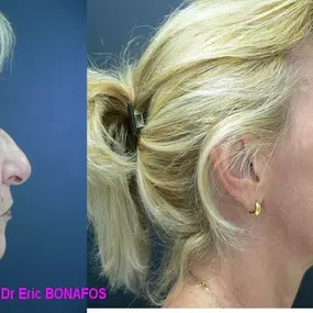 Bild von Dr Eric BONAFOS Chirurgien Esthétique Montpellier Chirurgie de la face et du cou