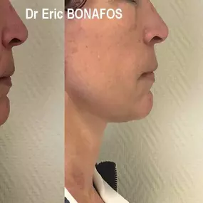 Bild von Dr Eric BONAFOS Chirurgien Esthétique Montpellier Chirurgie de la face et du cou