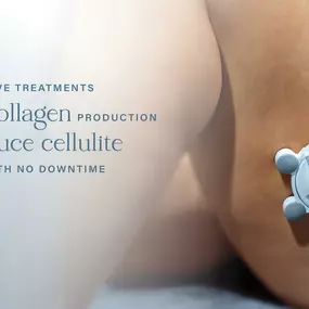 Cellulite Reduction
Using a non-invasive treatment without injections that improves early signs of aging, results in no downtime.