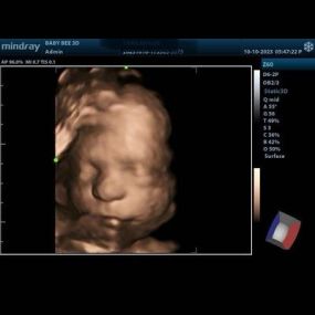 Bild von Baby Bee 3D Ultrasound (Fort Worth)