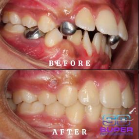 Bild von Super Orthodontics