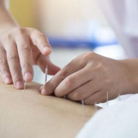 Bild von Cape Fear Acupuncture