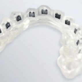 Elysee Dental Unortho