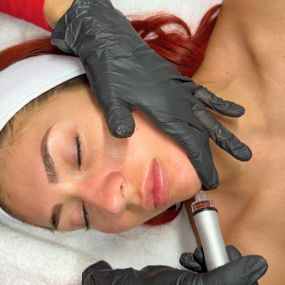 Microneedling at C10 Wellness in Miami, FL