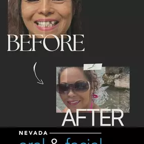 Bild von Nevada Oral & Facial Surgery - Henderson, NV