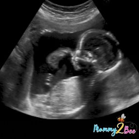 Bild von Mommy2Bee 4D Ultrasound