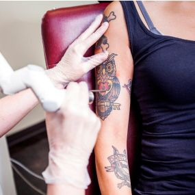 Ethos Medical Aesthetics & Wellness offers laser tattoo removal services to help you say goodbye to unwanted tattoos. Our advanced technology and skilled professionals are dedicated to safely and effectively fading or removing tattoos, giving you a clean slate.