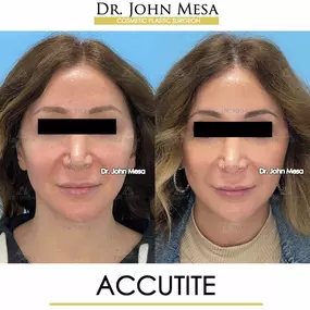 Bild von Dr. John Mesa, MD: Plastic Surgeon NYC, Buccal Fat Removal, Chin Liposuction, Facelift, Facial Masculinization, Chin Implant