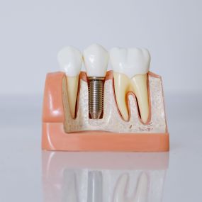 Bild von Advanced Family Dentistry