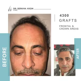 Bild von Hair Transplant Turkey | Dr. Serkan Aygin | London Branch Office