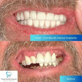 Bild von Tampa Dental Implants
