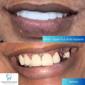 Bild von Tampa Dental Implants