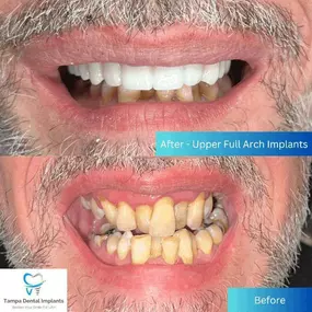 Bild von Tampa Dental Implants