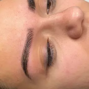 alopecia_cejas_despues_de_microblading.jpg