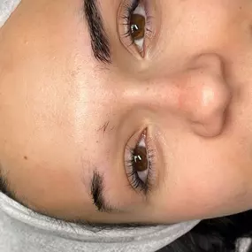 microblading_cejas_con_alopecia.jpg