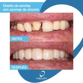 Clinica-demtal-y-Estetica-Velez-5.png