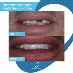 Clinica-demtal-y-Estetica-Velez-7.jpeg