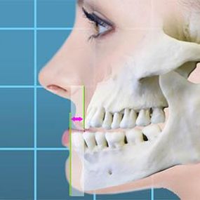 Bild von Kurpis Center For Implant & Cosmetic Dentistry