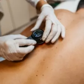 Desert Dermatology & Skin Cancer Specialists - doc scanning skin on man back