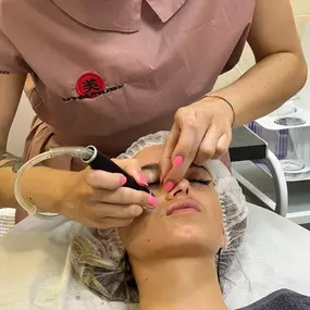 Microneedling-Dermapen-Centre-d-estetica-Belari.jpg