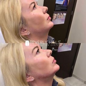 Bild von Beverly Hills Rejuvenation Center  - Quarry