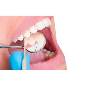 periodoncia.jpg