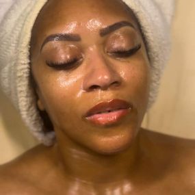 Smoother, Youthful Looking Skin After Facial at Waters Aesthetics - Phoenix, AZ