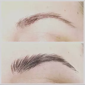 Eyebrow Treatments For Brow Growth - Waters Aesthetics Near Scottsdale, AZ