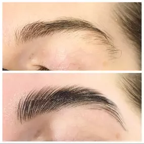 Flawless Eyebrow Treatment in Phoenix, AZ - Waters Aesthetics