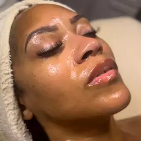 Results from Professional Facial in Phoenix, AZ - Waters Aesthetics