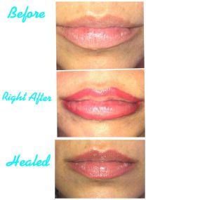 Flawless Permanent Makeup By Elsa in Staten Island, NY, offers lip tattoo services to enhance your natural beauty. Our skilled technicians use expert techniques to add color and definition to your lips, creating a long-lasting, vibrant look that saves you time on daily makeup application.