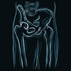 There are a number of different conditions that can result in hip pain and inflammation. Arthritis, bone cancer, sports injuries, and trauma related injuries can interfere with the proper feel and function of the hip bone and joints. There are surgical, non-surgical, and minimally invasive surgical options to treat the wide variety of causes related to hip pain.