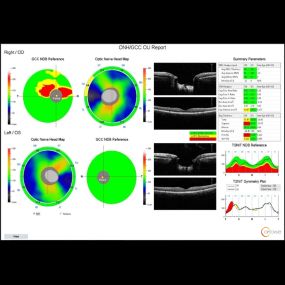 Bild von Roholt Vision Institute North Canton