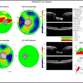 Bild von Roholt Vision Institute North Canton