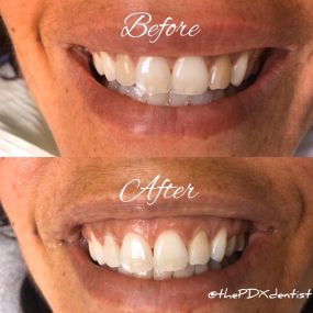 Before and After of Cosmetic Dentist care