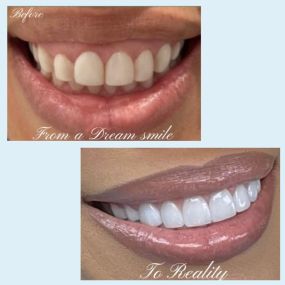 Dr. Jessie Carolina Camacho and her team at JC Dental Care in Houston, TX, are dedicated to providing high-quality oral health care and smile correction services. With a focus on patient comfort and positive experiences, Dr. Camacho and her team are highly regarded by their patients.