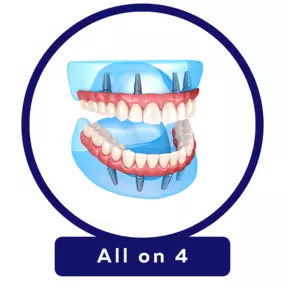 Equipped with an in-house lab, negative pressure surgical rooms, and top-of-the-line technology and equipment, when you choose JC Dental Care, you can trust that your dental care is in good hands. Unlike other offices that outsource their appliance manufacturing to a third party, our team keeps the process under our roof, meaning fewer appointments for you and guaranteed quality.