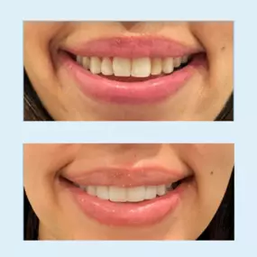 Dr. Jessie Carolina Camacho and her team at JC Dental Care in Houston, TX, are dedicated to providing high-quality oral health care and smile correction services. With a focus on patient comfort and positive experiences, Dr. Camacho and her team are highly regarded by their patients.