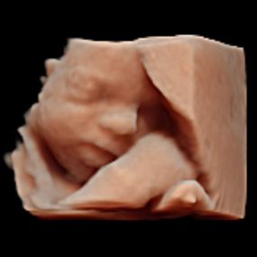 Bij Echocentrum KeiK kun je terecht voor verschillende zwangerschapsecho’s. Voor medische echo’s maar ook voor pretecho’s. Een speciaal moment met jullie kindje, in een vriendelijke en prettige omgeving waarbij je gegarandeerd bent van een kwalitatief goed echoscopisch onderzoek. Ben je zwanger en wil je een echo van je baby, maak dan een afspraak bij Keik.