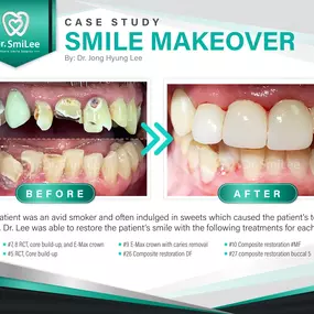 Dr. SmiLee - Cosmetic Family Emergency dentistry of Waco, TX 76710