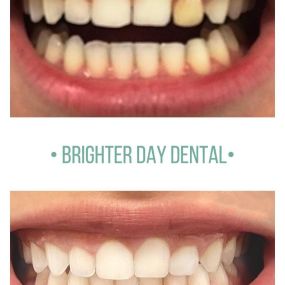 At Brighter Day Dental, we can help you feel confident in your smile!