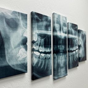 Bild von Mesa Dental Implants & Dentures