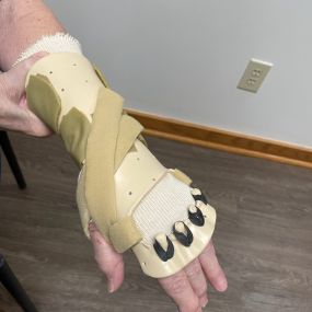 Custom made low profile radial palsy splint