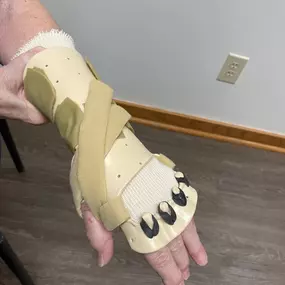 Custom made low profile radial palsy splint